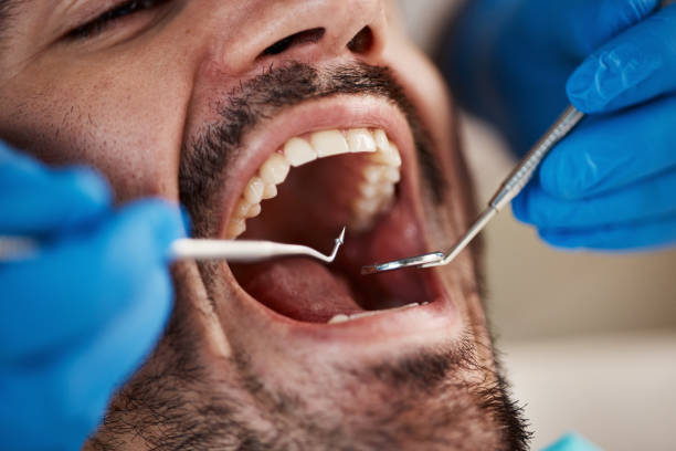 Best Emergency Gum Pain Relief  in Garnet, CA